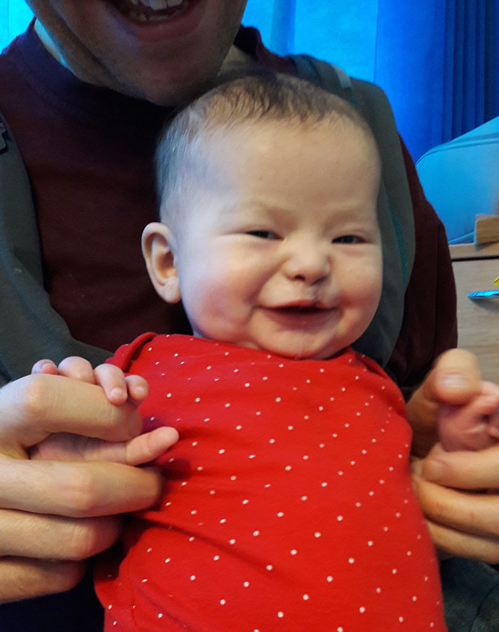 After his first surgery (March 2017)